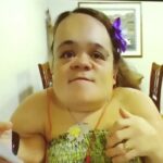 Eine Frau mit Behinderung schaut auf die Kamera